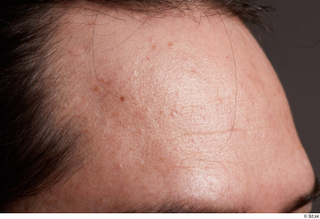 HD Face Skin Kevin Sarmiento face forehead skin pores skin…